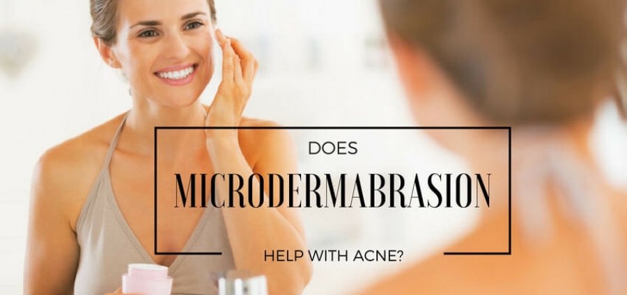 Does Microdermabrasion Help with Acne?