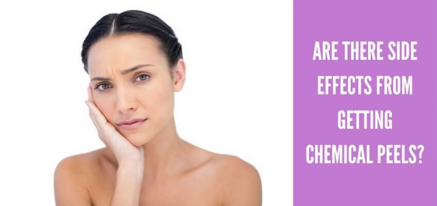 Are there Side Effects from Getting Chemical Peels?